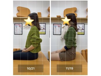 ナオル整体 飯田橋院(NAORU整体)/Before After/飯田橋/整体・矯正