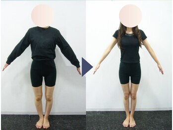 美デザイン 溝の口店(美.design)/☆美脚Ｏ脚+美尻骨盤+お腹くびれ