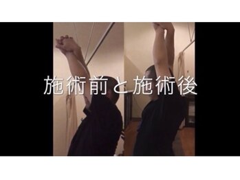 ホットちょっと 南船橋店(HOTちょっと)/肩甲骨のコツは肩甲骨！