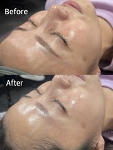 シュシュビエン(Chou Chou Bien)/ララピールで韓国女優肌に◎