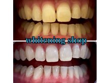 ホワイトニングショップ 葵区静岡駅店/ホワイトニング店ホワイトニング