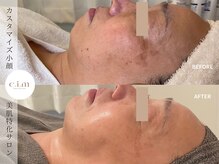 エイム(e.i.m)/60代：たるみケア・シミケア