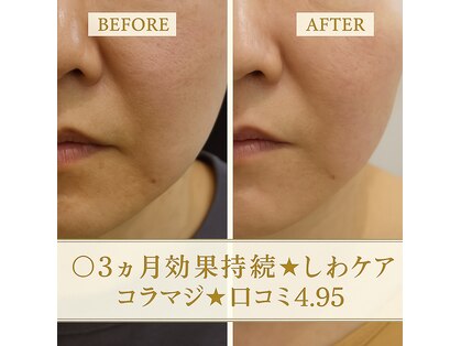 ジオリッチシフォン(giorich chiffon)の写真