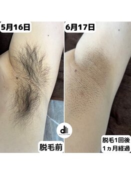 ビューティーサロン マル(Beauty Salon MARU)/