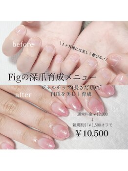 フィグ(Fig)の写真/【深爪育成】深爪でお悩みの方、これから爪を育てたい方におすすめ