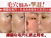 エー プラス リラボ(A plus Relab)