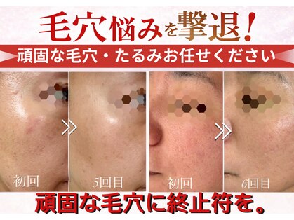 エー プラス リラボ(A plus Relab)の写真
