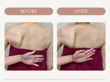 フローラ(FLORA)/天使の羽美ボディリンパ