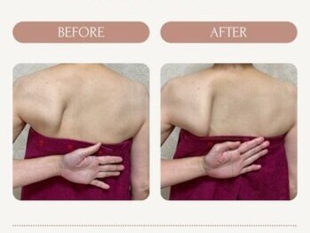 フローラ(FLORA)/天使の羽美ボディリンパ