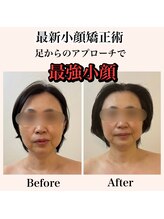 佳園/足からもアプローチする小顔矯正