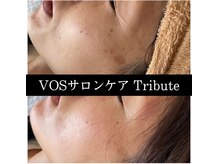 トリビュート(Tribute)/VOSサロンケア《Tribute》