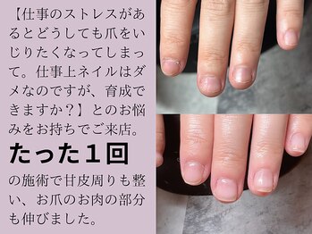 サロンエヌ(salon enu)/パラジェル深爪緩和クリアコース
