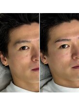 ビビ(BB)/眉スタイリング&WAX脱毛