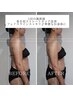 【肩ボトいらず！盛り肩徹底集中！】美容整体+上半身リンパ +ヘッド　90分 