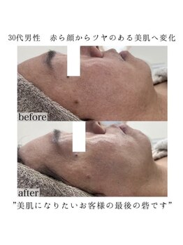 ヴェルシック(Belchic)/赤ら顔の方も多数ご来店