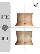 ミル 恵比寿店(Mill)/《痩身》