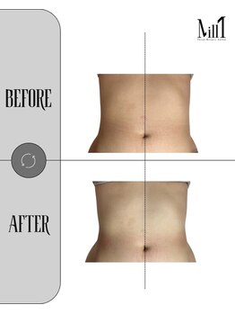 ミル 恵比寿店(Mill)/《痩身》
