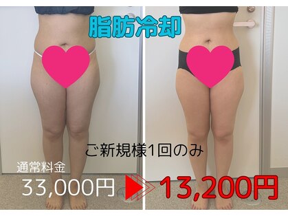 ベル(Belle)の写真