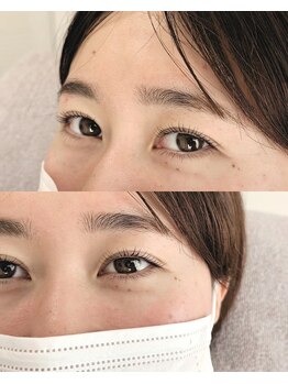 アイバード(eyebird)/マツパ/ラッシュリフト