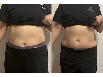 ベラ/初回腸もみ結果【腸もみよもぎ】