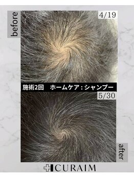 クリスタルグロウ 苫小牧大町店(Crystal Glow)/CURAIM育毛促進施術