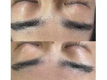 ビオプラス(BIO PLUS)/【毛穴】毛穴エクストラクション