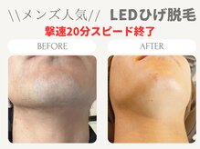 美々庵の雰囲気（痛み＆肌負担も軽減した最新LED脱毛でスピード卒業！）