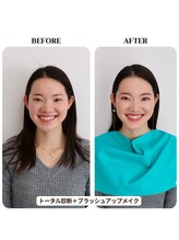 シュアリー(Surely)/トータルコースお客様