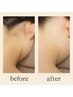 満足度◎うなじ美人に☆WAX+光脱毛通常¥6,000→新規価格¥5,500