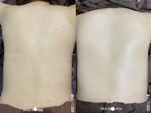 フルール(Fleur)/■背中トリートメント■