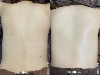 フルール(Fleur)/■背中トリートメント■