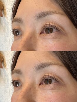 ヘアーウニール アイ(Hair Unir eye)/【50代前半】若々しいお目元