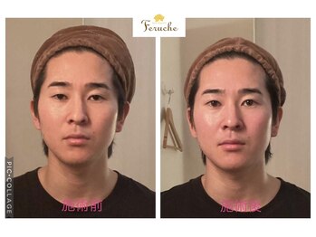 小顔コルギ専門店 フェルーシュ 成田駅前店(Feruche)/小顔コルギ　1回目　結果写真