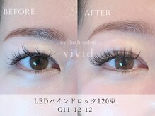 ビビッド(vivid)/【LEDバインドロック120束】