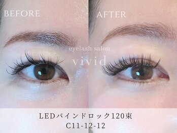 ビビッド(vivid)/【LEDバインドロック120束】