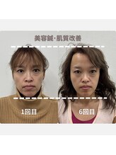 鍼灸Labo アルシア/