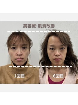鍼灸Labo アルシア/