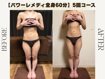 ルカ 北堀江(Luca)/太ももの横張りも削ぎ落とす。