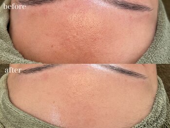 リボーン 浜松(reborn)/