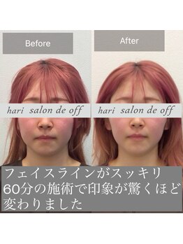 ハリサロンドオフ 南森町店(hari salon de off)/小顔効果抜群