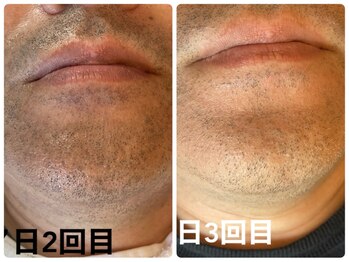 リジュ(Reju)/おヒゲメニュー人気です！