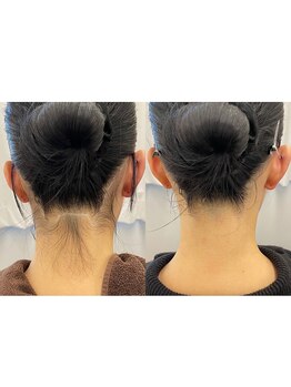 ルククギフ 岐阜(〇△□rukuku)/美肌うなじ脱毛