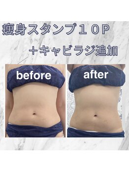 ハロ 南青山(HALO)/痩身スタンプ10P+キャビラジ