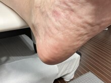 ルミエールサント(lumiere sainte)/足裏角質&タコ集中ケアコース