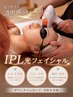 【ほうれい線撃退フォト】RF光フェイシャル ¥5,000