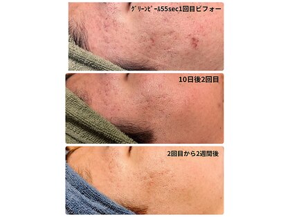 エヌクリア(N CLEAR)の写真