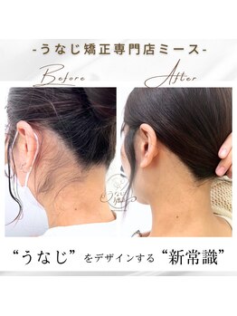 ミース 豊田店/うなじ矯正◆ビフォーアフター