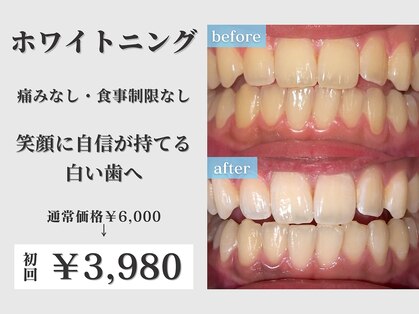 ぺルラ 島田駅前店(Perla)の写真