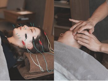 ヒノト(Hinoto)の写真/小顔矯正と電気美容鍼を同時に!【初回 ¥9,500】 優しい刺激で痛みが苦手な方でも◎ 初回から効果を実感!