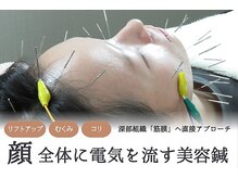 たかや鍼灸 整体院の雰囲気（施術は個室空間で安心して受けることができます♪）